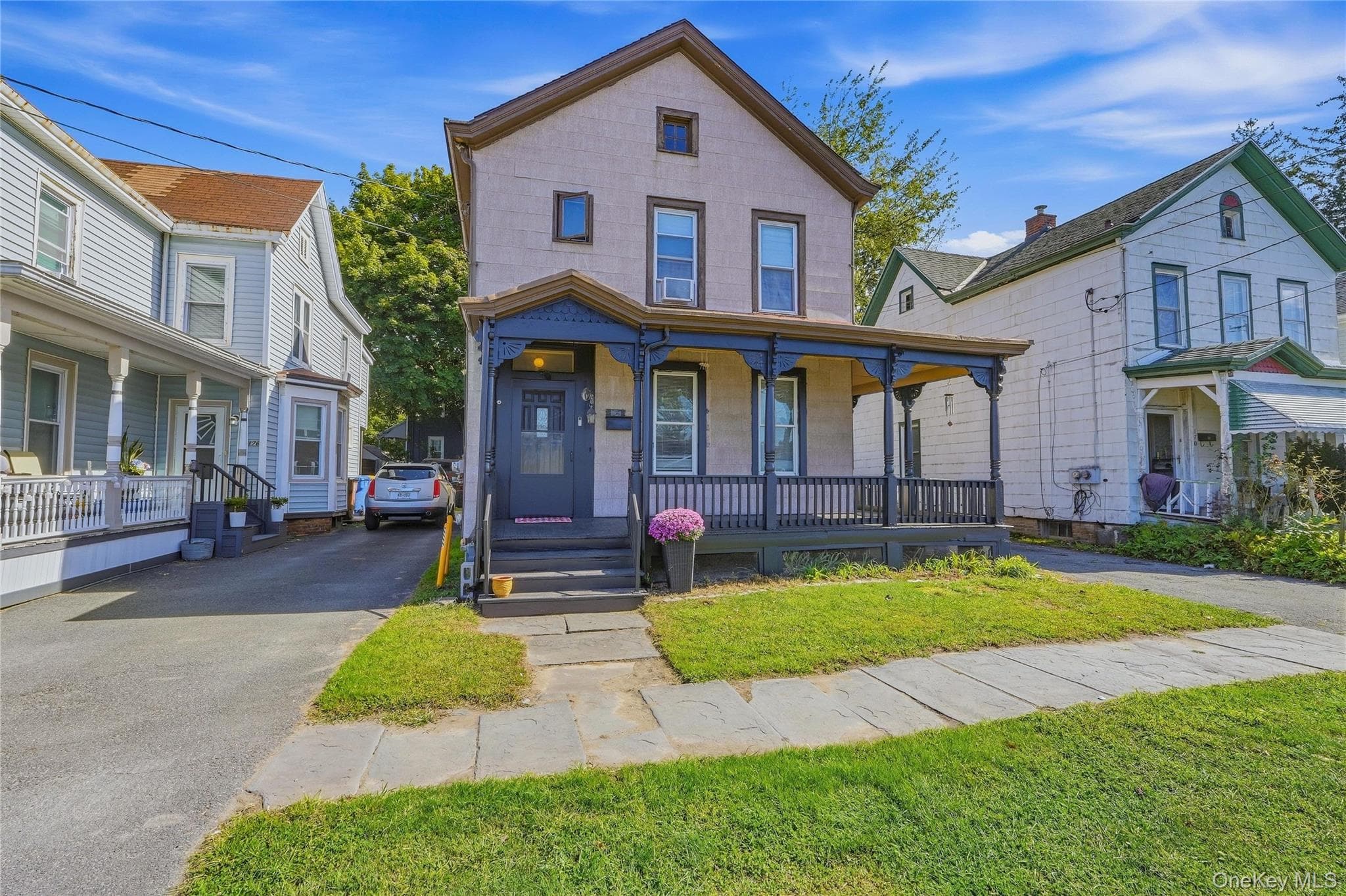 174 Foxhall Avenue thumbnail 2